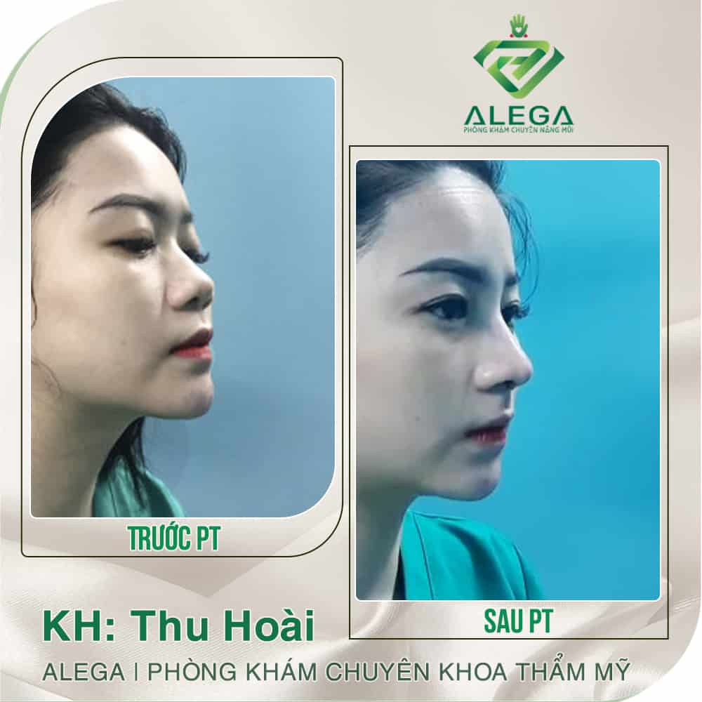 HINH ANH TRUOC SAU 1