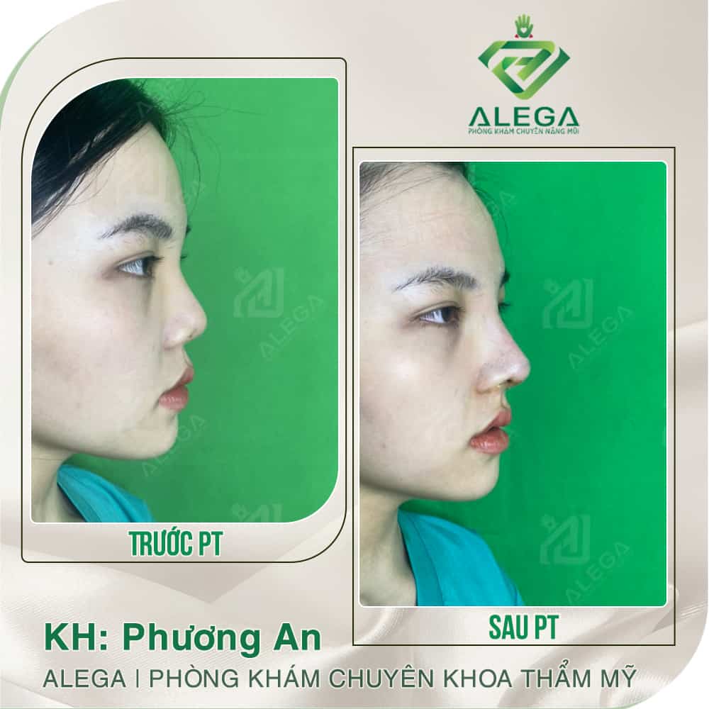 Hinh anh khach hang 1