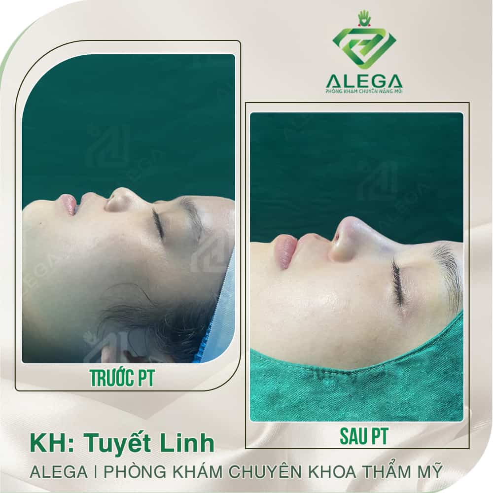 Hinh anh khach hang 2