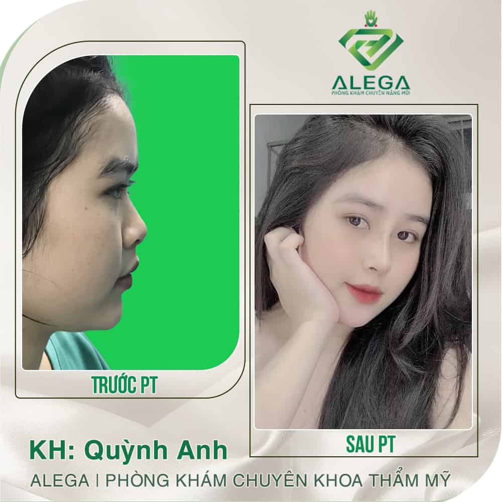 Hinh anh khach hang 3
