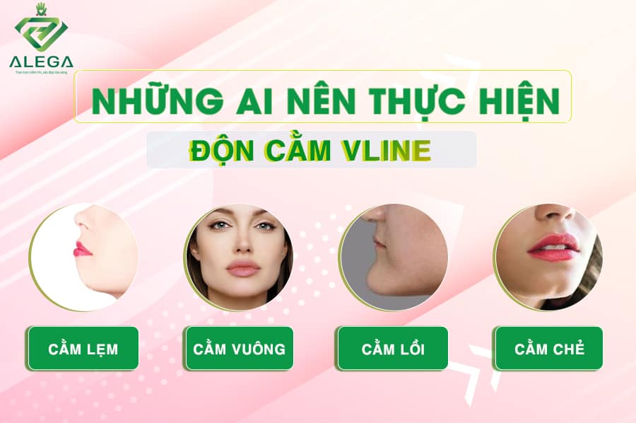 Nhung ai nen don cam vline