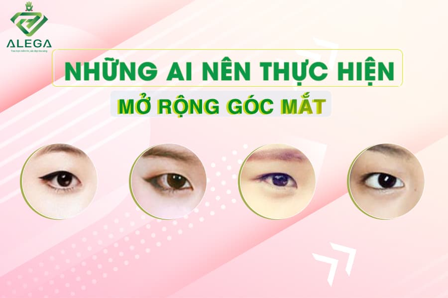 Nhung ai nen thuc hien mo rong goc mat