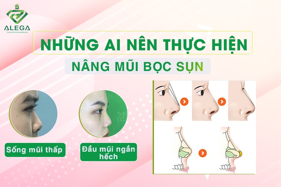 Nhung ai nen thuc hien nang mui boc sun