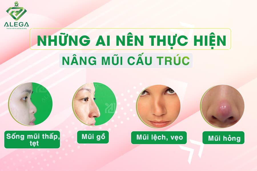 Nhung ai nen thuc hien nang mui cau truc