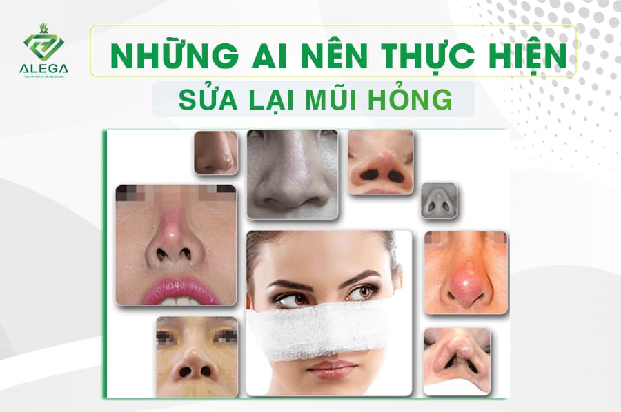 Nhung ai nen thuc hien sua lai mui hong