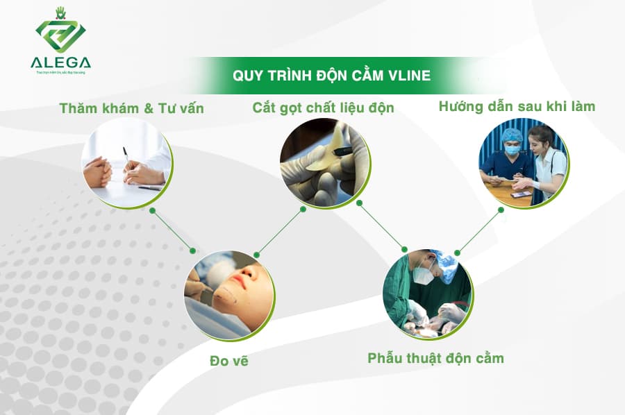 Quy trinh don cam vline