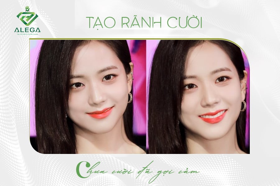 Tao ranh cuoi chua cuoi da goi cam