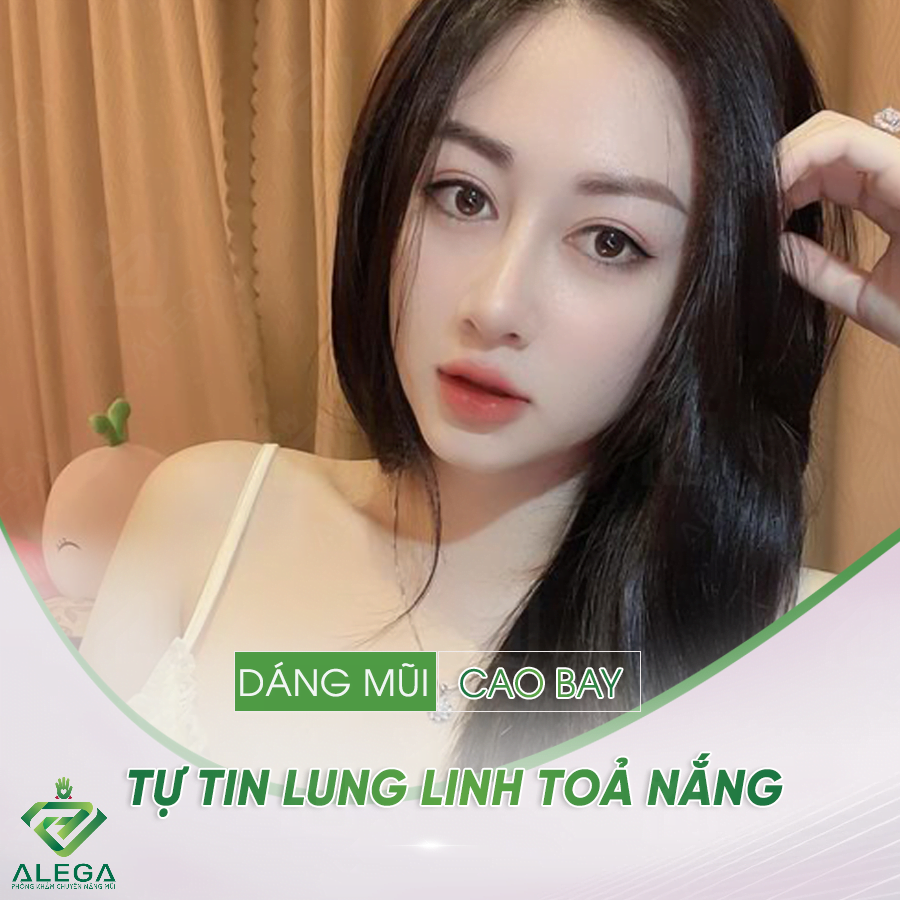 Nâng mũi Hàn Quốc 2 nc3